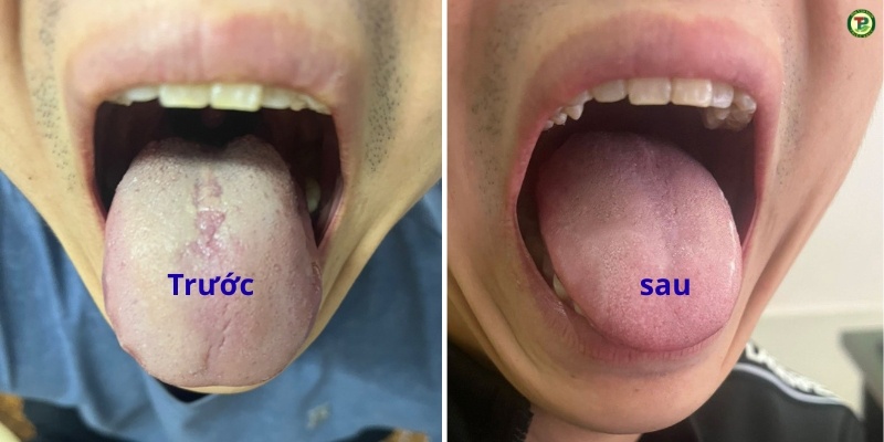 Công Trình Dự Án Nhà Anh Long